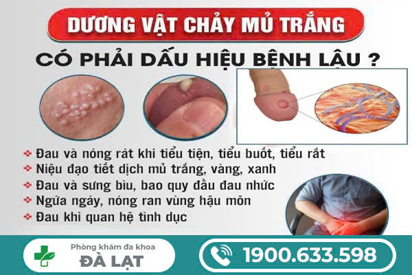 Hình ảnh minh họa